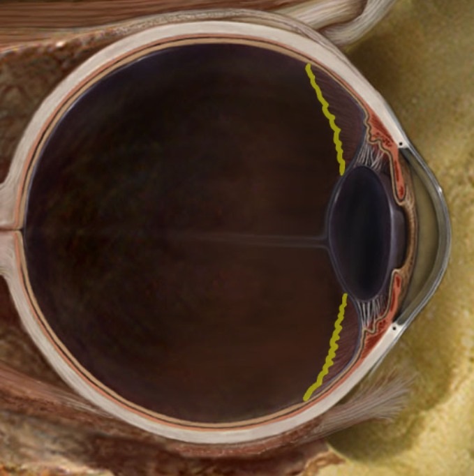 term image