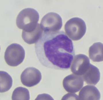 <p>What toxic change has happened in this neutrophil?</p>