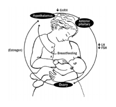<p><strong>Lactation Amenorrhea</strong></p><p>-Regular suckling maintains ________ levels</p><p>-Prolactin inhibits ____ → thus no FSH/LH</p><p>-Results in anovulation and ____________</p>