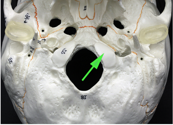 <p>What is the bump marked by the green arrow on the occipital bone?</p>