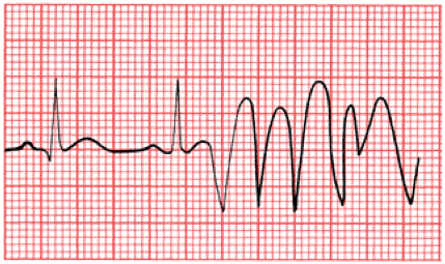 <p>Abnormal heart rhythm or heart rate</p>