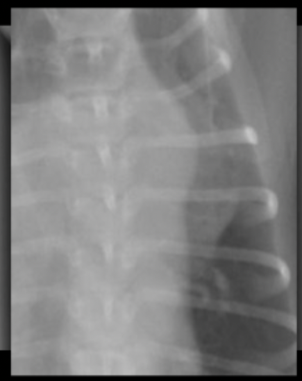 <p>What is seen in this magnified radiograph?</p>