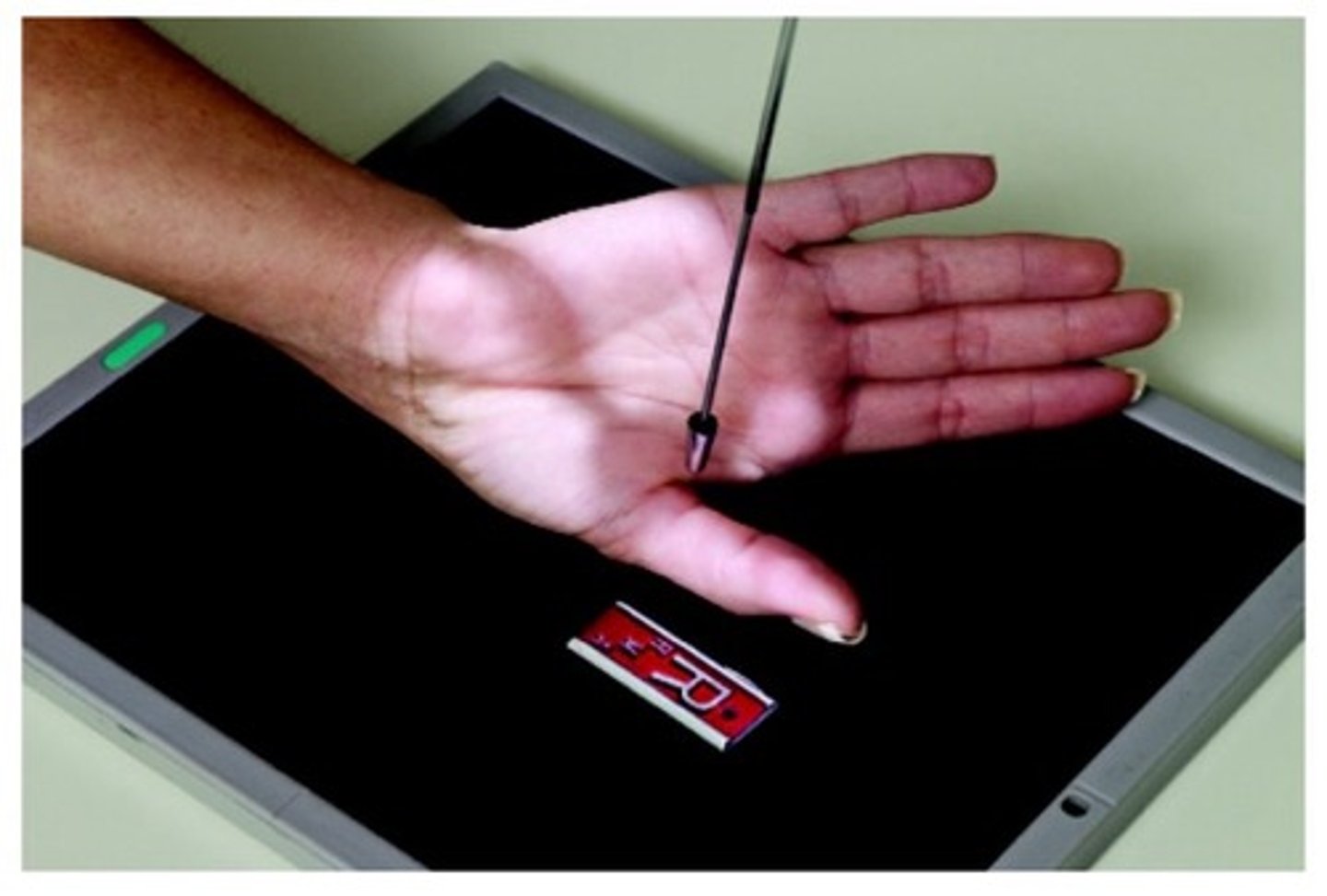 <p>perpendicular to first MCP joint</p>