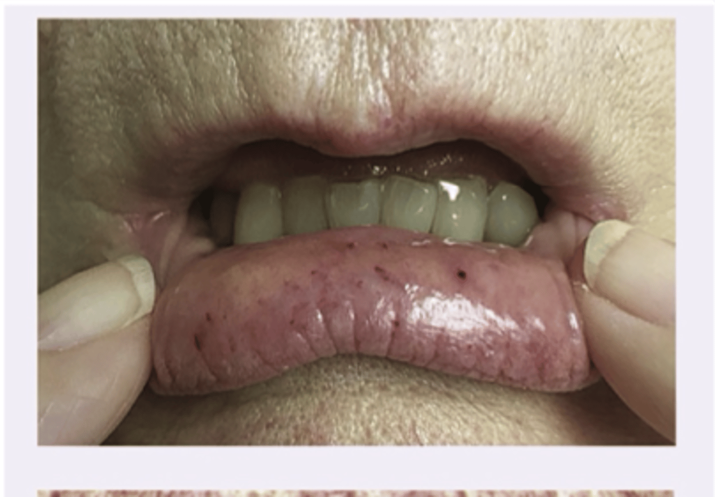 <p>Diagnosis?</p>