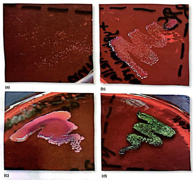 <p>Gram negative</p><p>Lactose</p><p>     Colored colonies</p><p>(Picture shows the growth on EMB agar a) gram-positive organism growing poorly due to inhibition by methylene blue in medium  b) gram-negative non-lactose fermenter c) coliform lactose fermenter with mucoid pink and purple growth d) E. coli with green sheen caused by rapid lactose fermentation)</p>
