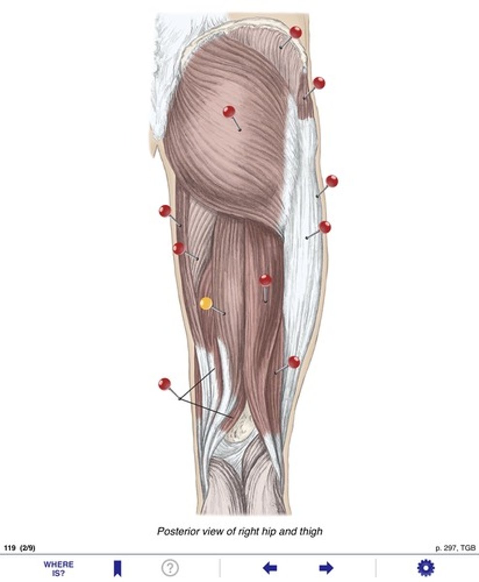 <p>Name the muscle at the yellow pin</p>