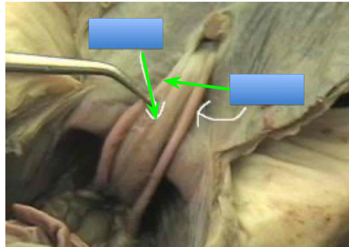<p>Identify the structure on the right</p>
