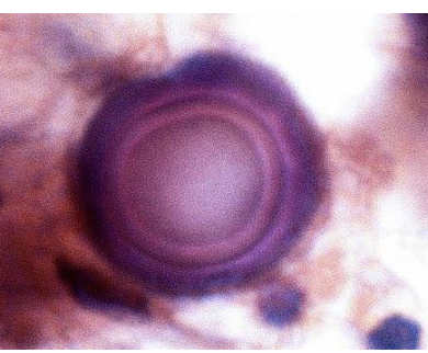 <p>Différentiel corps psammeux </p>