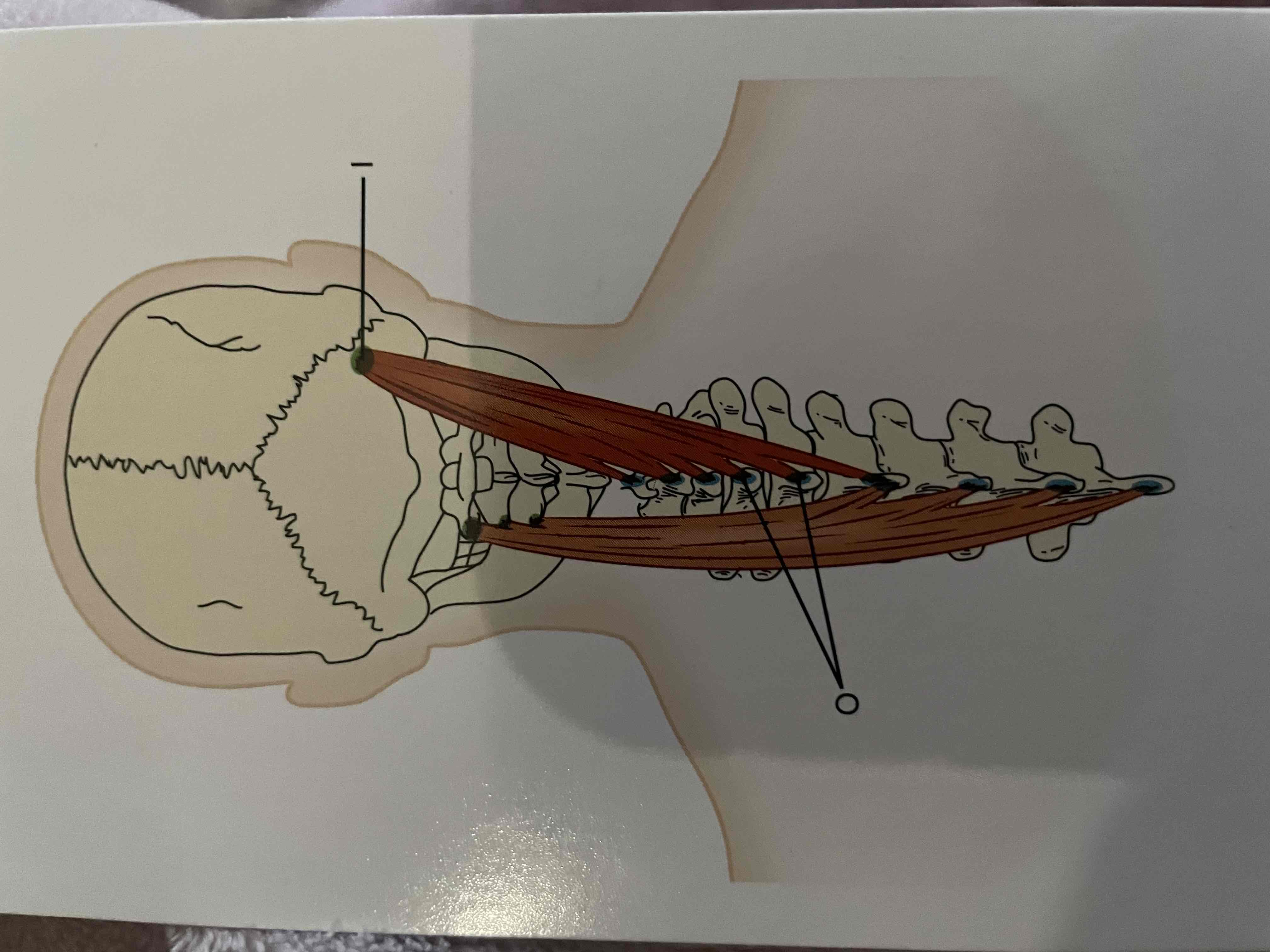 <p>Lower half of nuchal ligament; spinous processes of C7-T3</p>