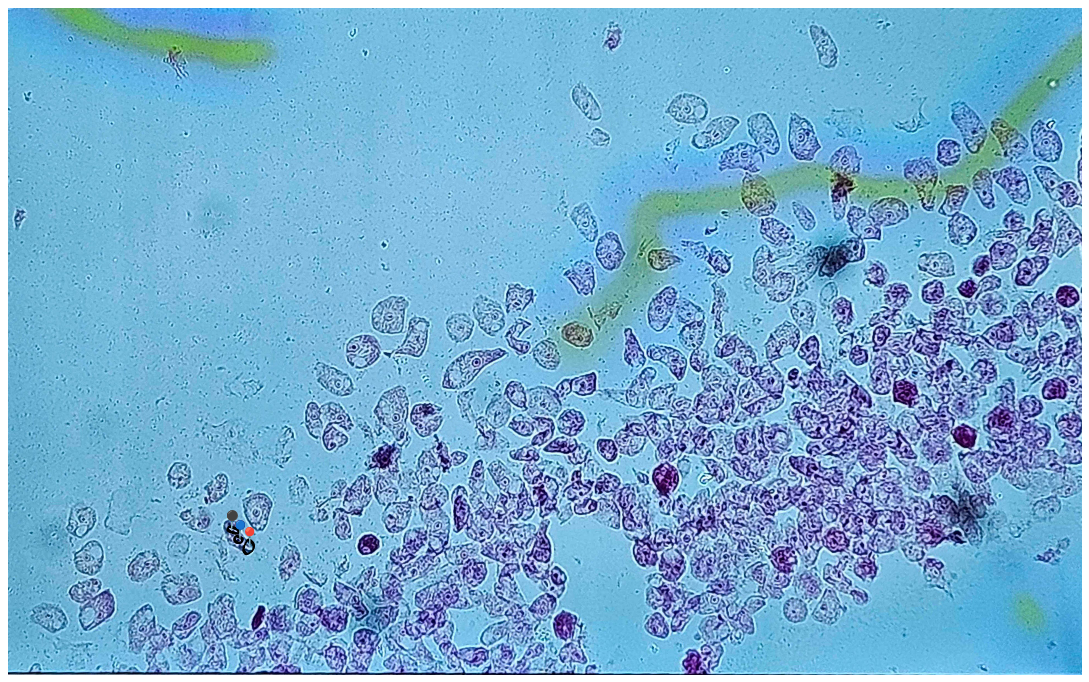 <p><strong><em>Acanthamoeba castellani</em></strong></p><p>(Trofozoit)</p><p></p><p><strong>Organelle:</strong></p><p></p><ul><li><p><span data-name="red_circle" data-type="emoji">🔴</span>- pseudopodium (akantopodium);</p></li></ul><p></p><ul><li><p><span data-name="red_circle" data-type="emoji">🔴</span><span> - </span>jądro komórkowe + kariosom;</p></li></ul><p></p><ul><li><p><span data-name="red_circle" data-type="emoji">🔴</span><span> - </span>wodniczka tętniąca.</p></li></ul><p></p><p></p><p><strong>Parazytoza:</strong> <em>Akantomeboza</em></p>