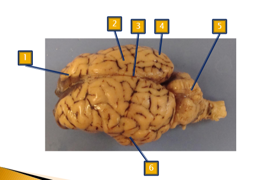<p>Lobes and Superior Structures</p>