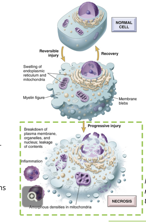 <ul><li><p>the cell membrane and remaining organelles lose structural integrity</p></li><li><p>holes can be observed using microscopy</p></li><li><p>the cellular contents spill out of the cell, producing inflammatory signals</p></li><li><p>the mitochondria’s proteins are released and lysosomal contents are exposed</p></li><li><p>cells nearby are exposed to these remains of the cell, and are also damaged or have apoptosis signalling triggered</p></li><li><p>unlike apoptosis, it is difficult for the body to clean up the cellular remains after necrosis</p></li></ul><p></p>