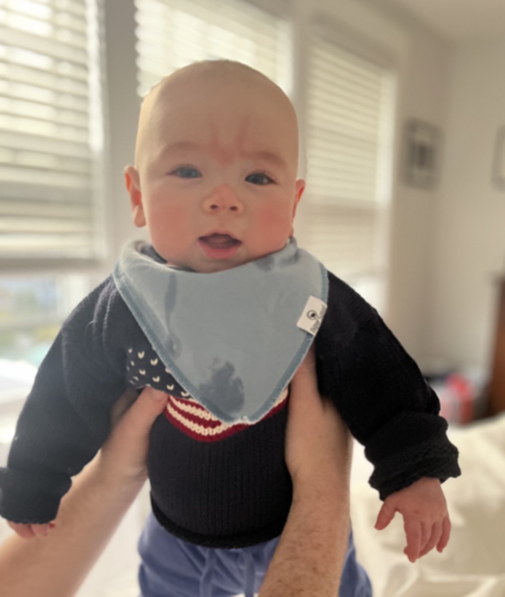 <p>flat, blanchable, often resolve by age 2 </p>