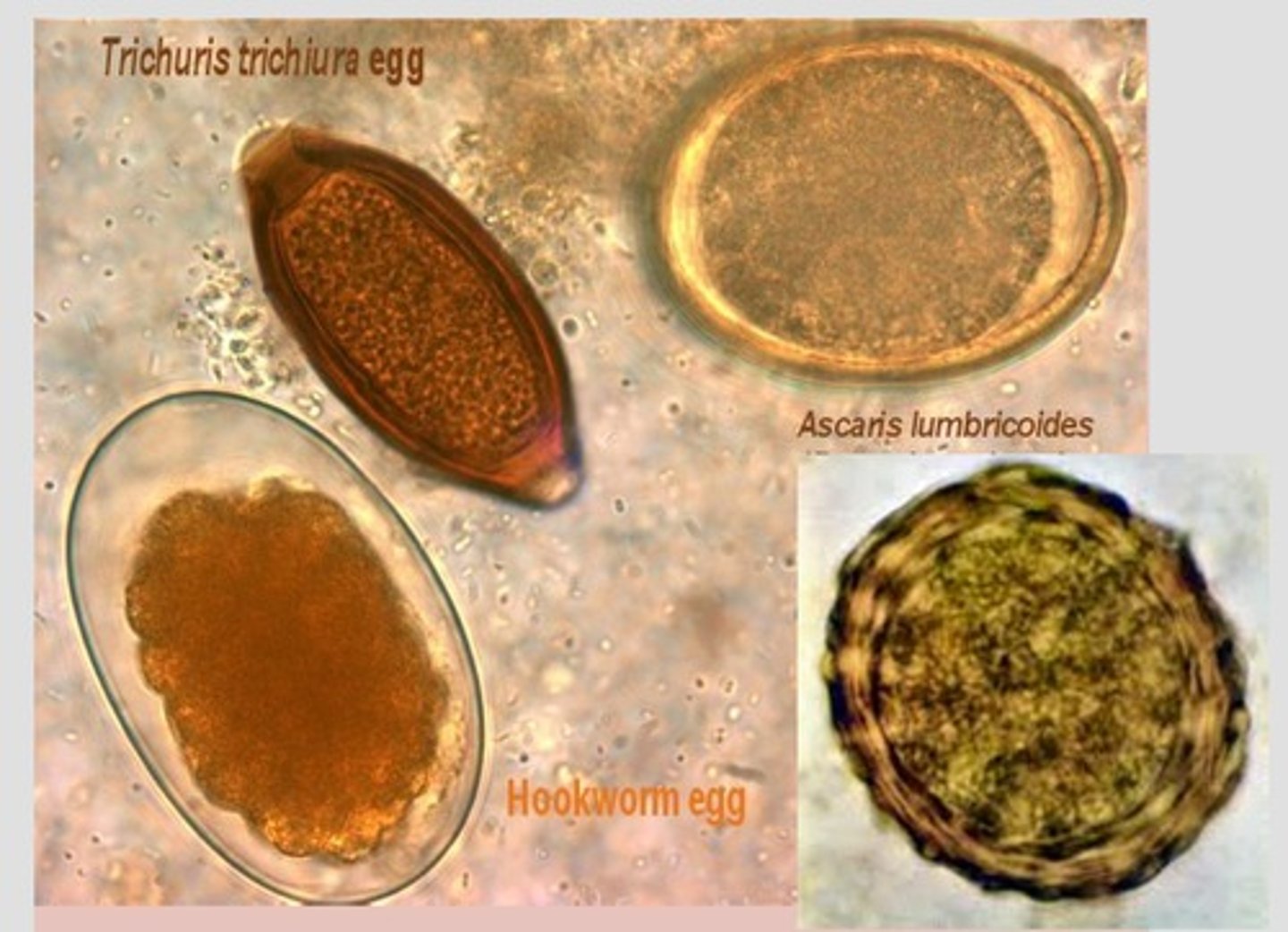 <p>Mixed infections with these two parasites are often seen in fecal specimens. Which two ova are present?</p>
