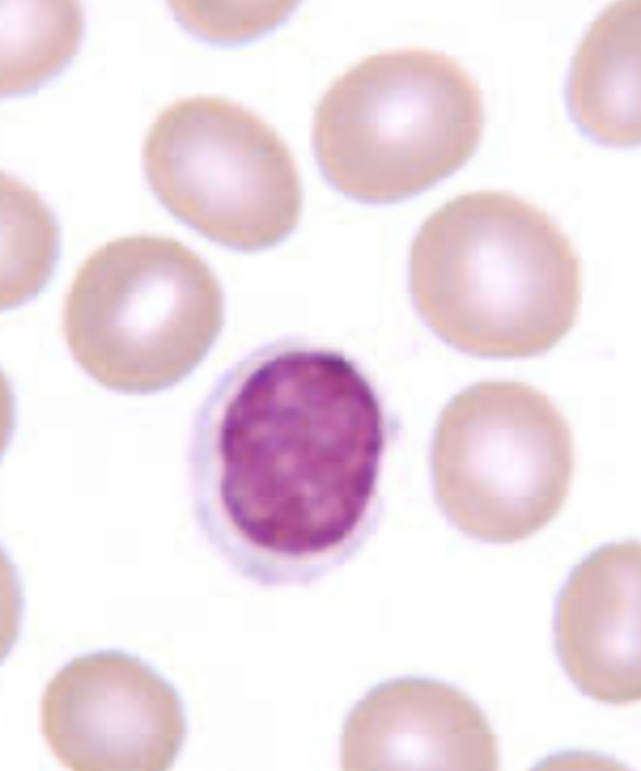 <p>nucleus fills up almost the whole cell and leaves a sliver of cytoplasm </p><ul><li><p>dont confuse with basophil (these are smooth) </p></li></ul><p></p>