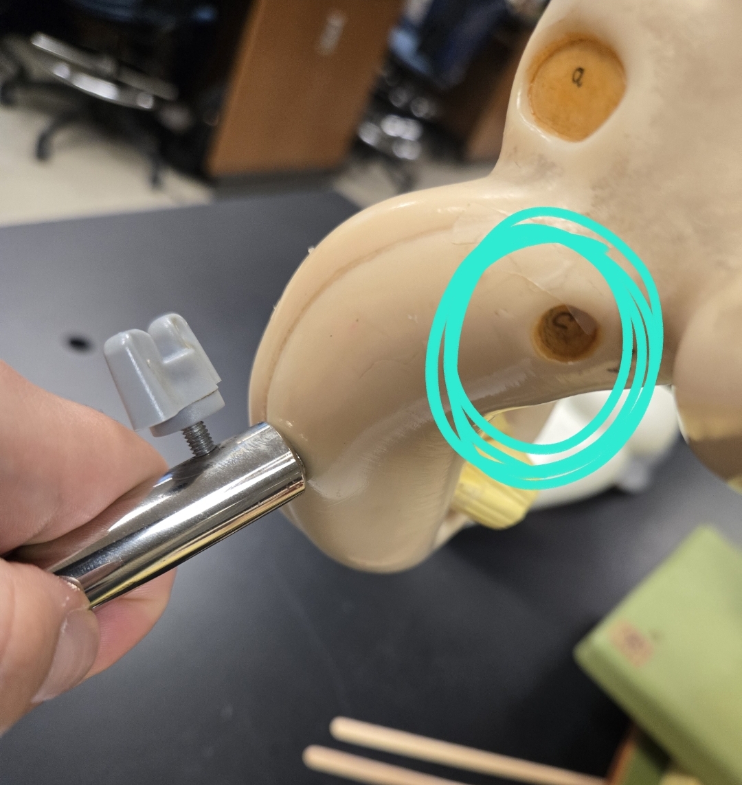 <p>Inner ear </p>