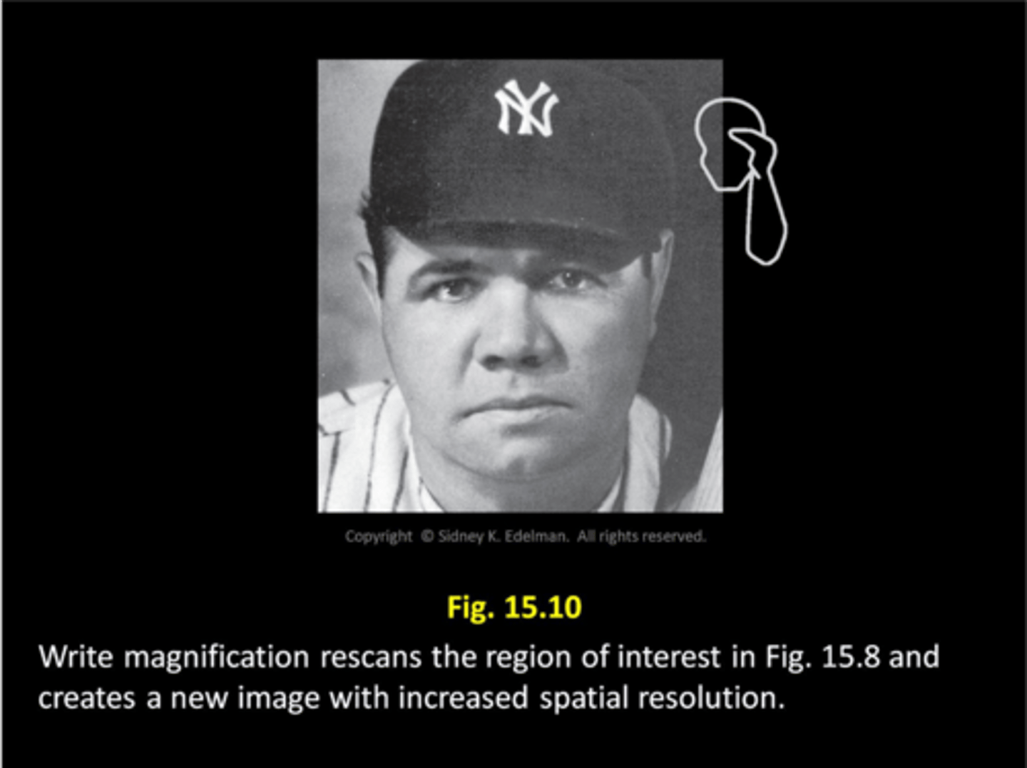 <p>1. system scans the anatomy and creates image</p><p>2. image is converted from analog to digital and stored</p><p>3. ROI is identified, old data is discarded</p><p>4. system rescans only the ROI and writes new data into scan converter</p>
