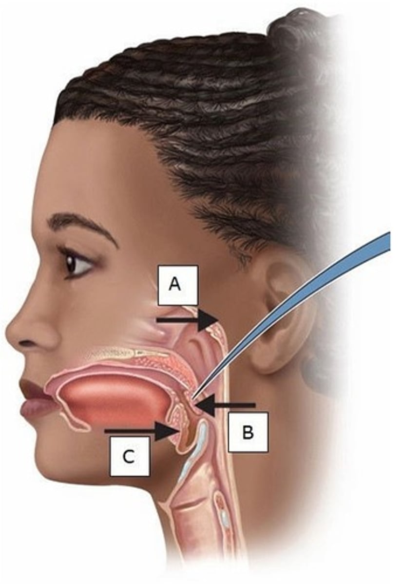 <p>Which of these is referred to as the palatine tonsils?</p><p>A) A</p><p>B) B</p><p>C) C</p><p>D) A and B</p><p>E) B and C</p>