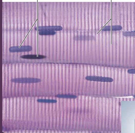 <p>skeletal muscle</p>