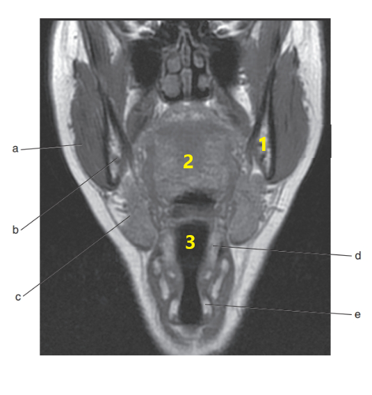 <p><span><span>What is # 1 ?</span></span></p>