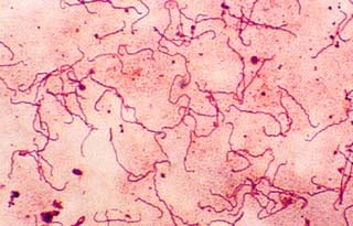 Gram negative, spirillum morphology, motile, cause syphilis