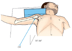 The projection of the shoulder demonstrated in this figure is the: