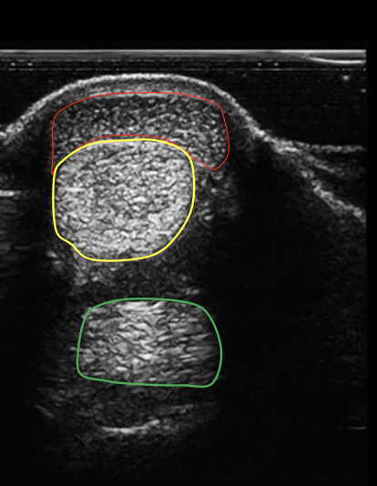 <p>what structure is circled in red?</p>