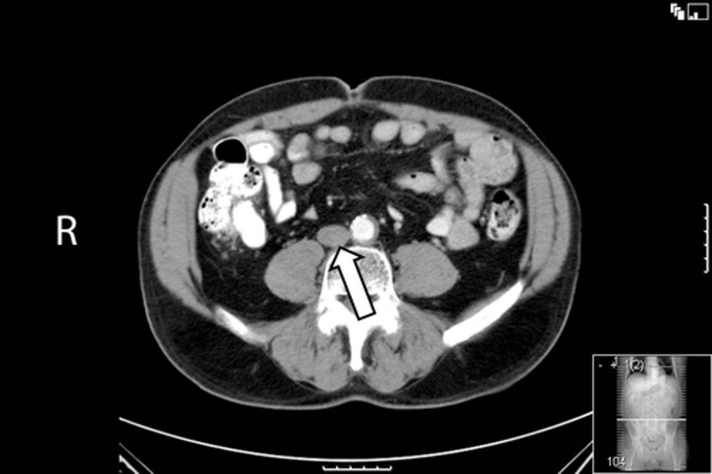 <p>What is indicated in the image?</p>
