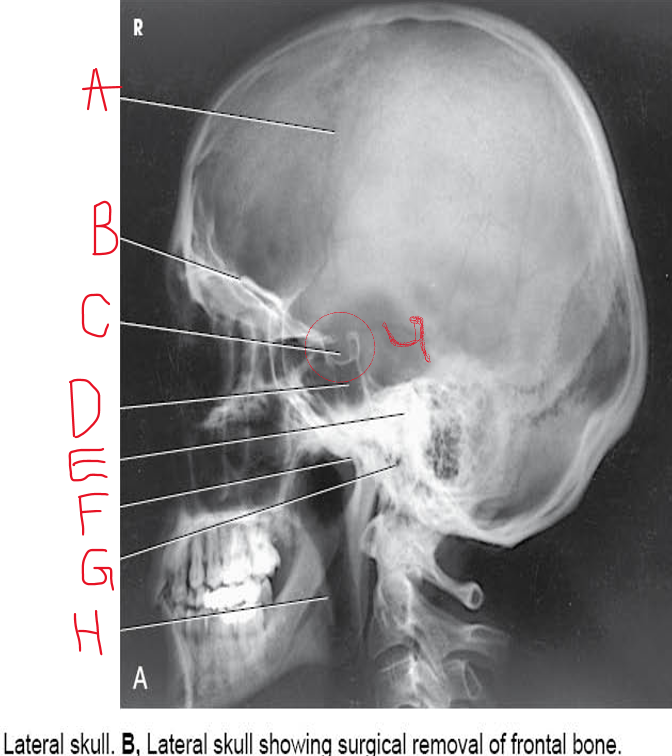 <p>A B &amp; C</p>