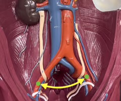 <p>Identify the blood vessel.</p>