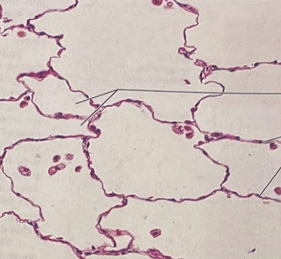 <p>Simple squamous</p>