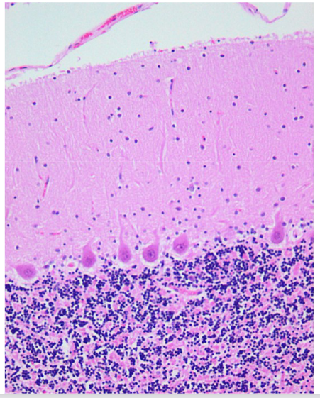 <p>HISTOLOGIE: lagen van cerebellaire cortex (HE)</p>