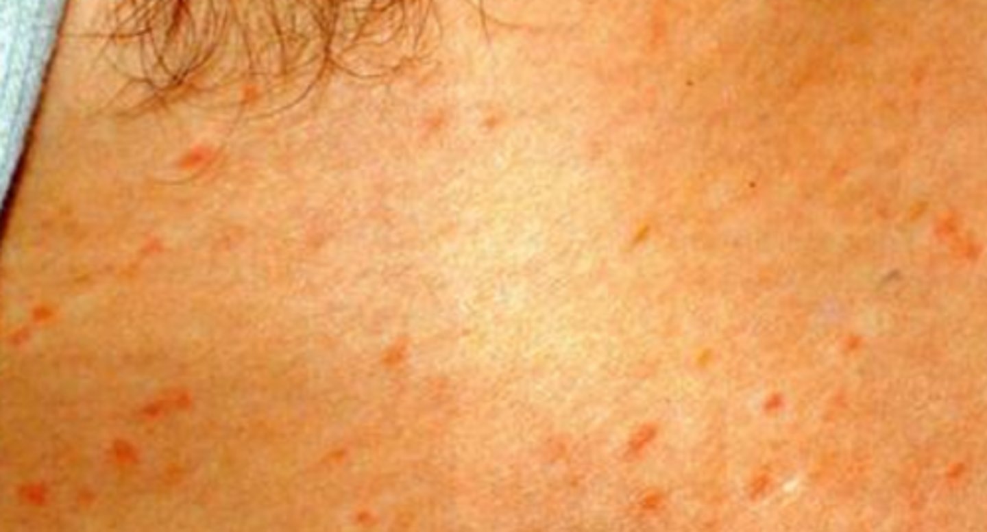 <p>What is the diagnosis?</p>