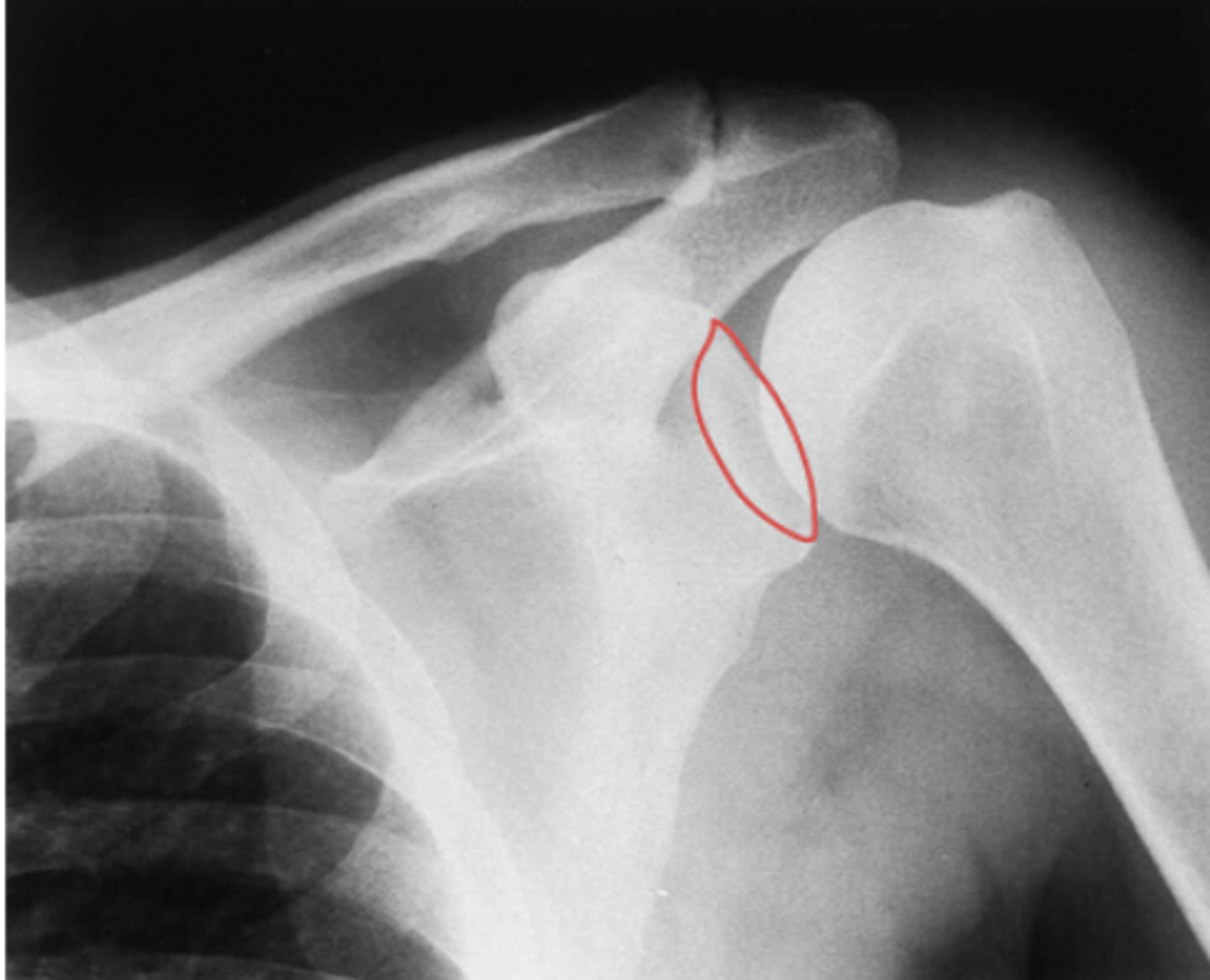 <p>What structure is highlighted?</p>