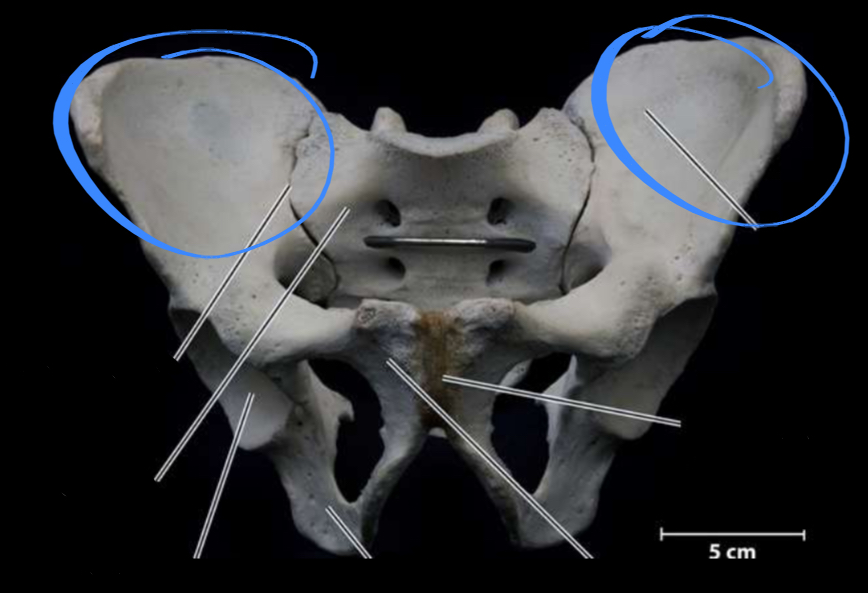 <p>Colloquially referred as the hip bone</p>