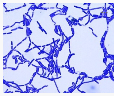 <p>Chains of bacillus</p>