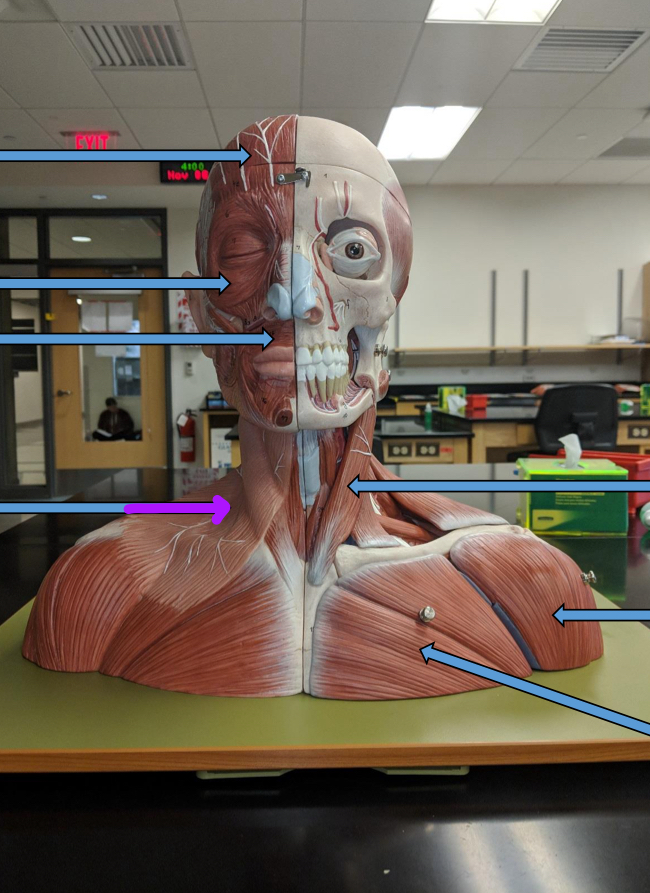 <p>Identify this muscle?</p>