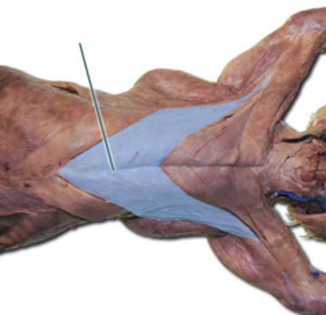 knowt flashcard image