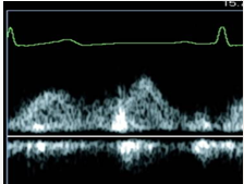 <p>what is measured </p>