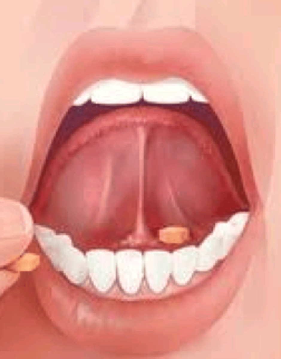 <p>1/11 Route of Administration</p><p>- med taken UNDER the TONGUE</p><p>- drug is absorbed into capillary -&gt; into bloodstream</p><p>- BYPASSES GI tract &amp; 1st pass metabolism(liver)</p><p>- acts FASTER than PO(oral)</p><p>*oral mucosa may be damaged if u take too much 'this' method</p>