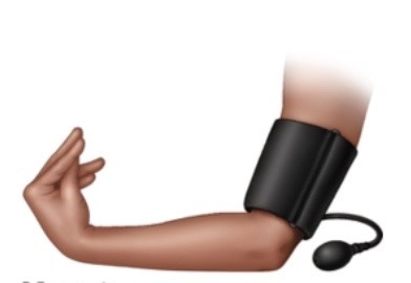 <p>hand/finger spasms with sustained blood pressure cuff inflation; suggestive of hypocalcemia</p>