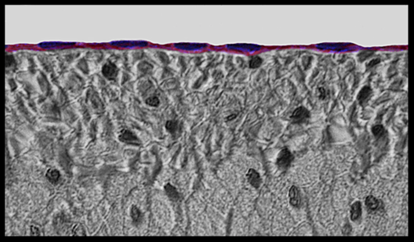 <p>lines blood vessels</p>