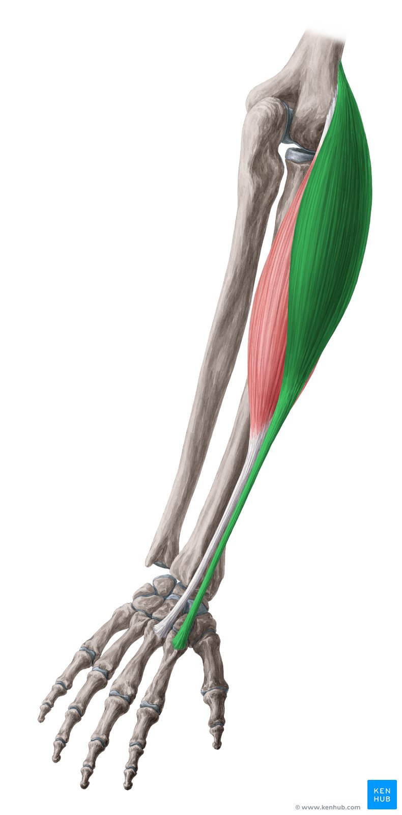 term image