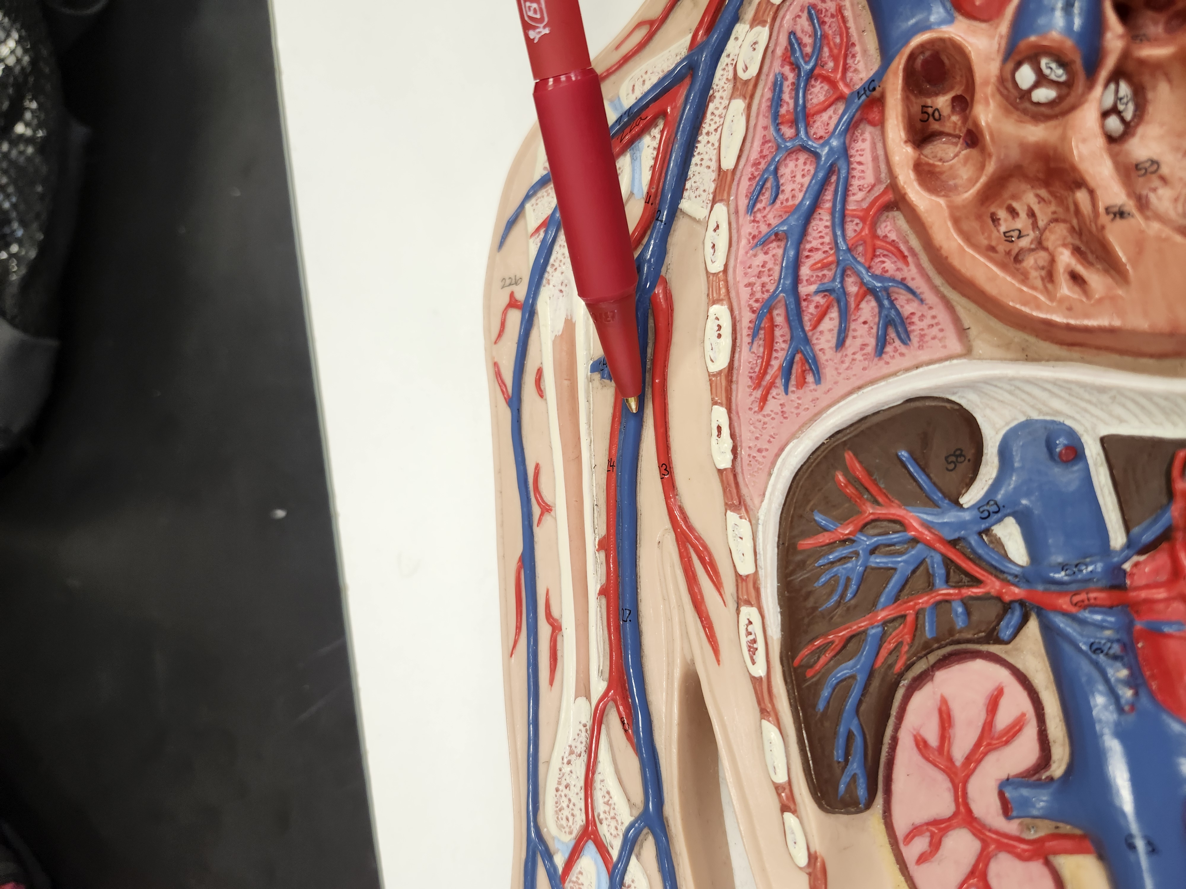 <p>Not brachial, but…</p>