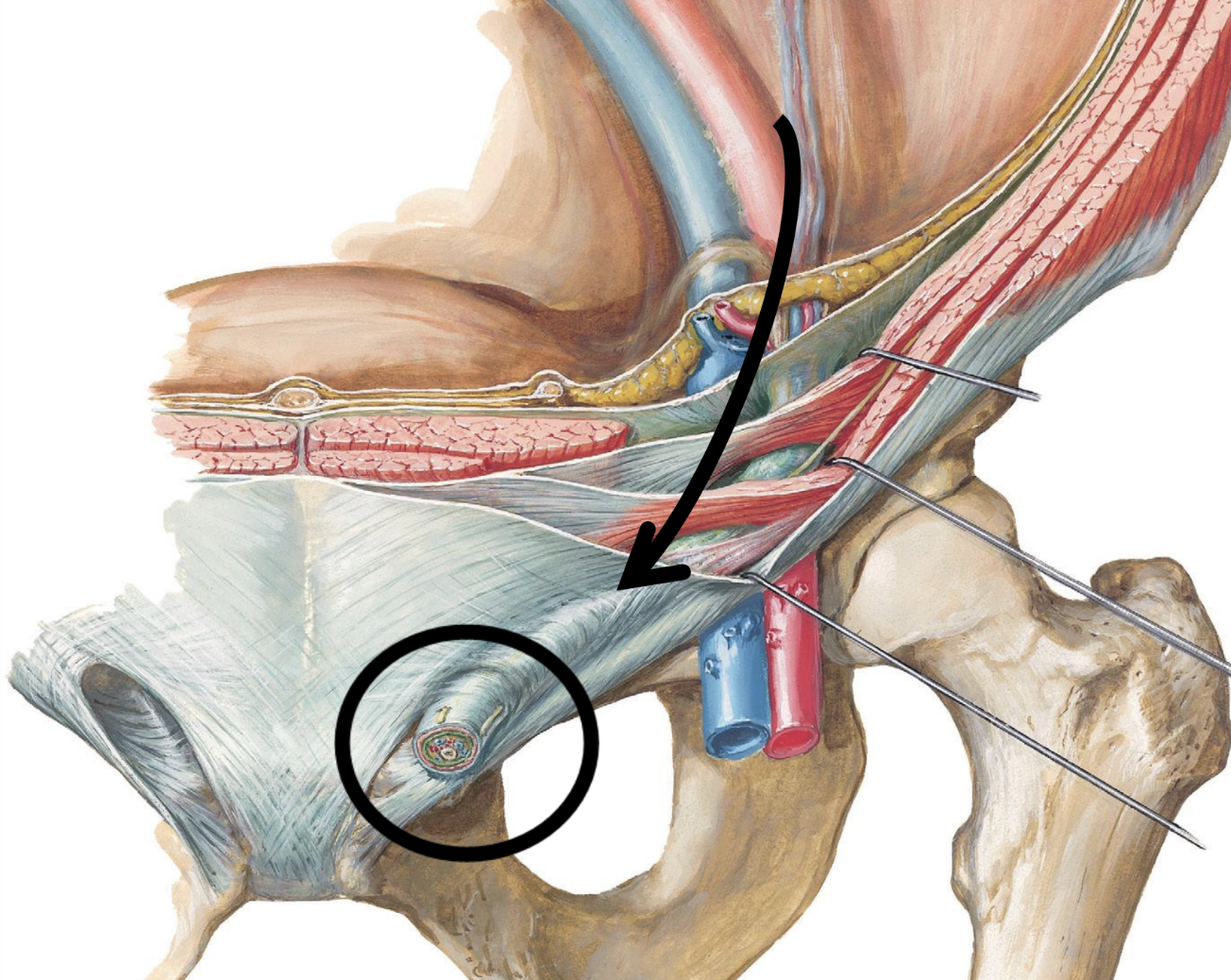<ul><li><p>passageway through the abdominal wall allowing for the passage of the testes and the spermatic cord into scrotal sac</p></li></ul><p></p>