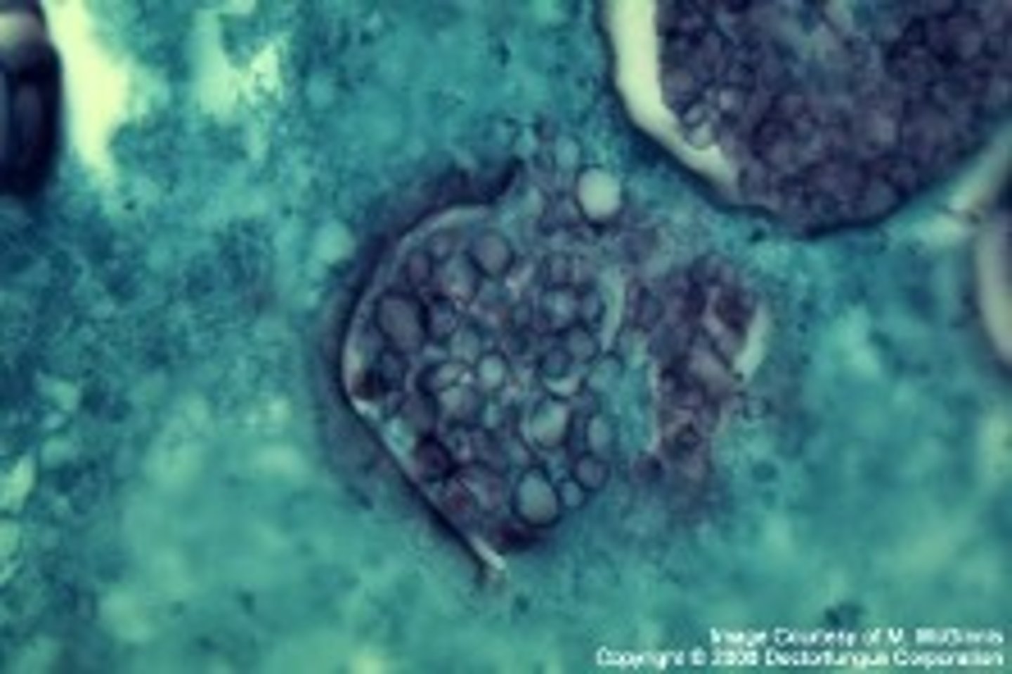 <p>(Yeast form)</p>