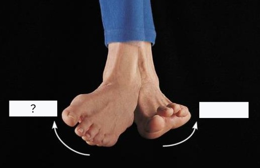 <p>Inversion</p>