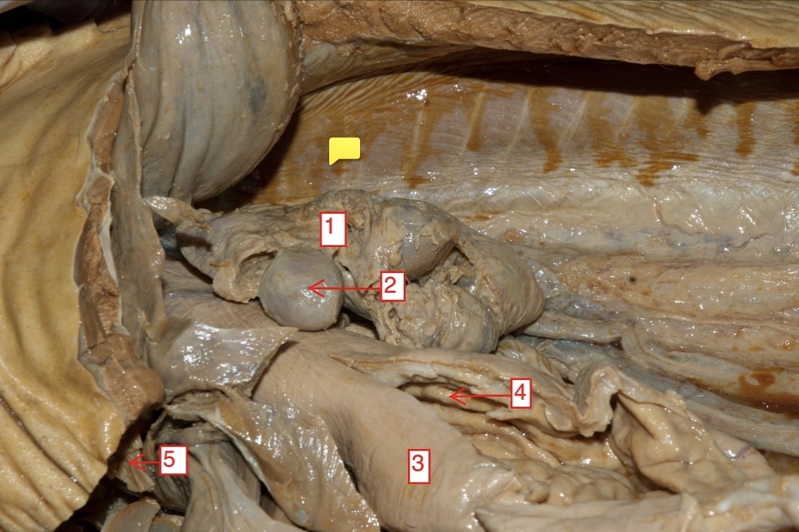 <p>female spiny dogfish- (1)</p>