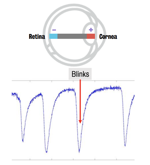 Deflection caused by blink