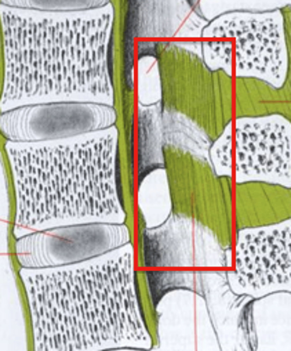<p>What's this?</p><p>ligamentum flavum</p>